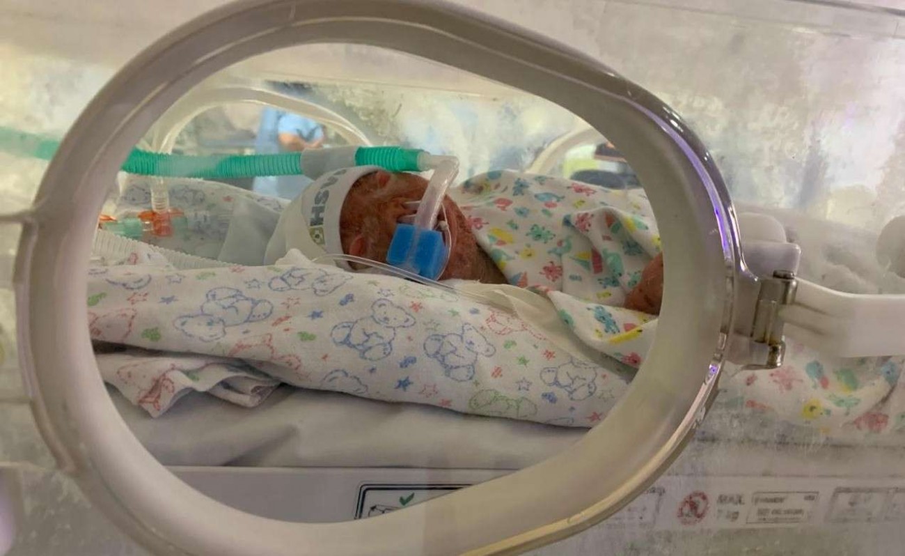 Com síndrome rara, o pequeno João Guilherme luta pela vida e precisa de ajuda