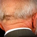 Lula dá entrada em hospital para resolver problema na cabeça