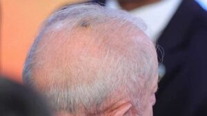 Após estranho tratamento contra câncer, pesquisa testa cenários sem Lula e o resultado é avassalador